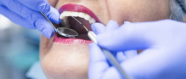 Best Emergency Wisdom Tooth Extraction in Clay City, IN